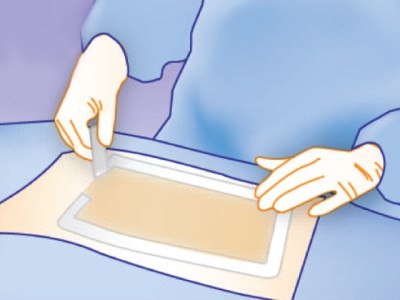 Antimicrobial Wound Care Products By PharmaPlast