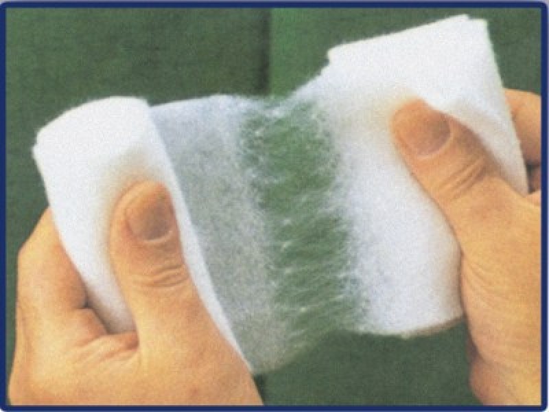 Casting and Bandaging By PharmaPlast